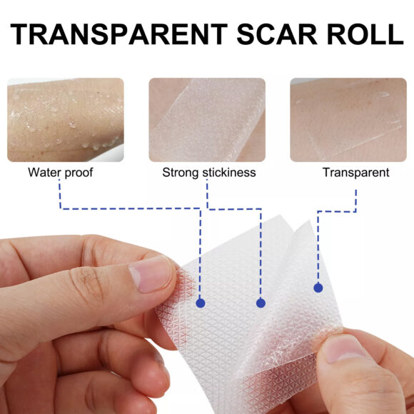 Elaimei Silicone Scar Sheets 3m Roll Tape