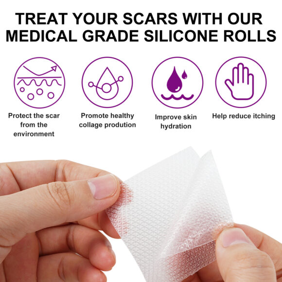 Elaimei Silicone Scar Removal Gel Tape Roll for Skin Treatment Repair 1.5 m