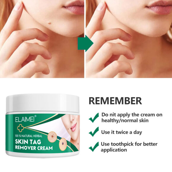 Elaimei Skin Tag Remover Cream, 100g