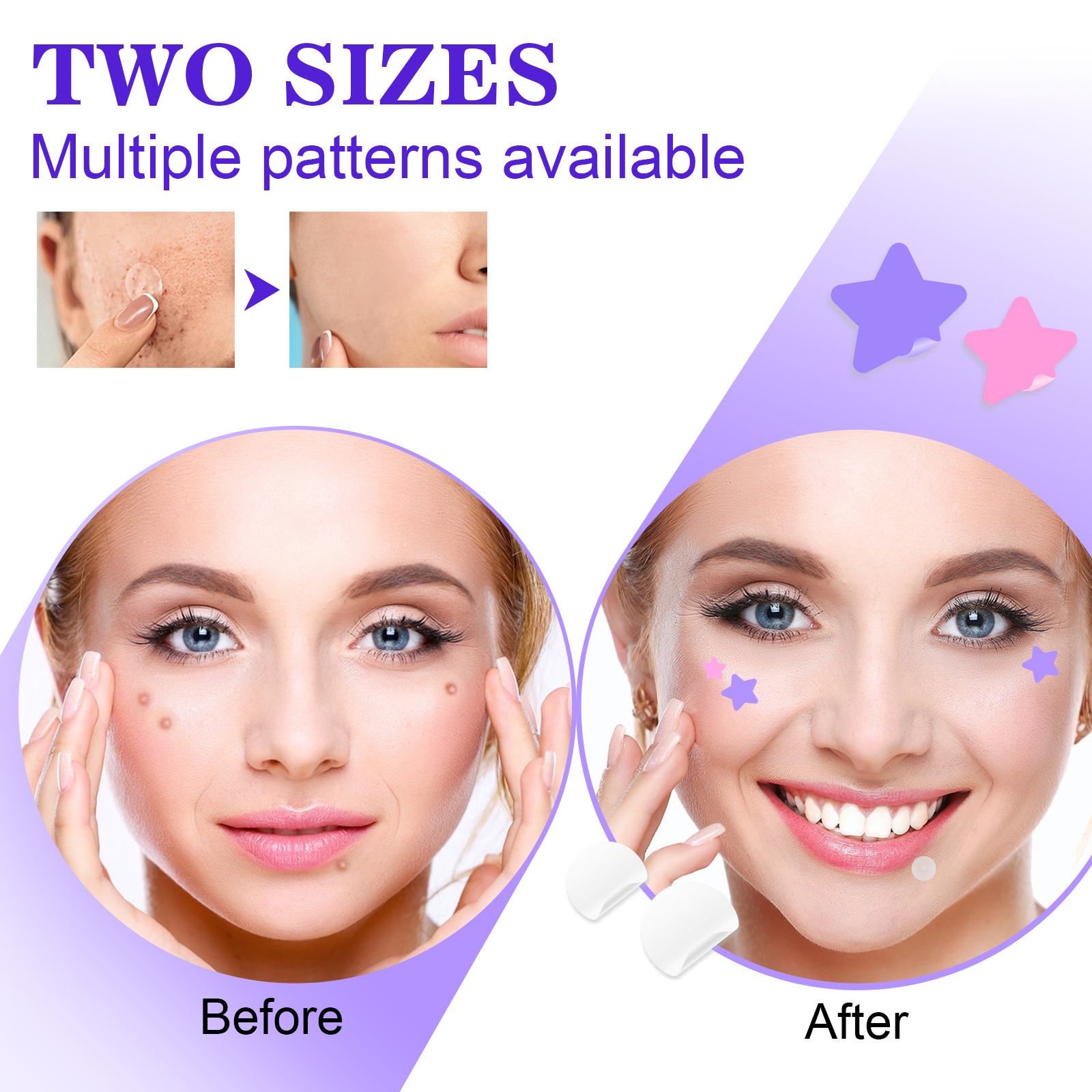 Elaimei Stars + Round Acne Patches, pack of 126pcs