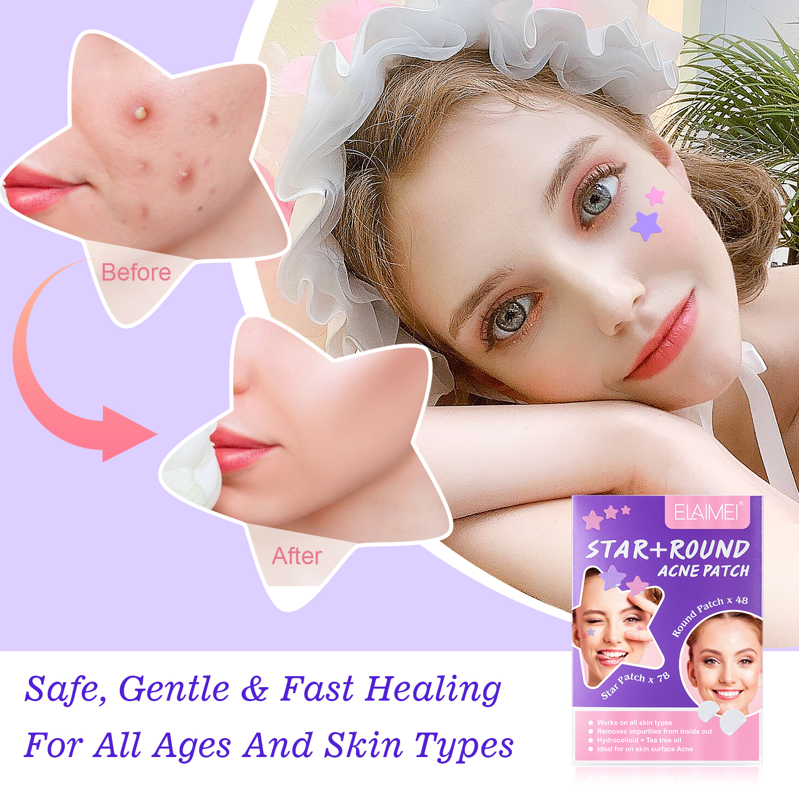 Elaimei Stars + Round Acne Patches, pack of 126pcs
